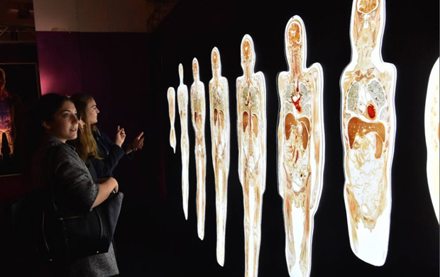 Real Bodies, scopri il corpo umano. Allo Spazio Ventura - Milano